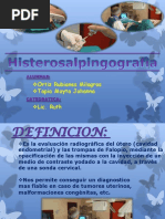 Histerosalpingografia 131203130843 Phpapp02