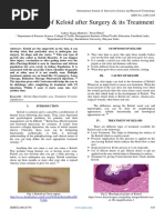 Development of Keloid After Surgery & Its Treatment