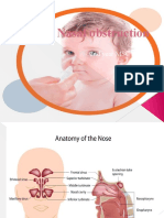 Nasal Obstruction: Nitha K 2nd Year MSC Nursing