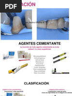 Protesis Fija-2do Parcial