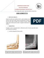 Caso Clínico. Epicondilitis Lateral