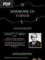 Sindome de Turner