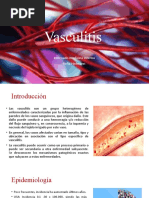 Vasculitis 2