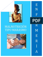 Malnutrición Tipo Marasmo