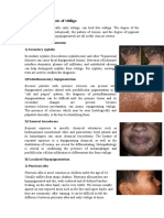 Differential Diagnosis of Vitiligo: A) Localized Depigmentation 1) Secondary Syphilis