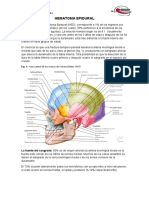 Hematoma Epidural y Hematoma Subdural