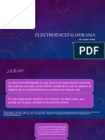 Electroencefalograma: Md. Janina Torres Postgradista de Pediatria Univesidad Del Azuay