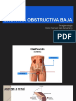 Uropatía Obstructiva Baja