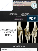 Grupo 2 - Meseta Tibial