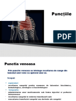 Punctiile