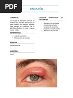 Chalazion