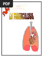 Rotafolio de La Tuberculosis