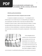 Tecnicas Radiograficas Intraoral