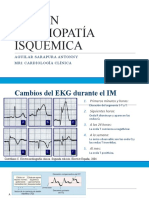 Ekg en Cardiopatía Isquémica