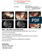 Seven Star Hospital, Nagpur: Ercp + CBD Sems Stenting Done