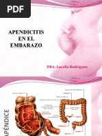 Apendicitis en El Embarazo