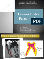 Lésions Endo Paro