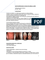 Quimioterapia y Quimioradioterapia en Cáncer de Cabeza y Cuello