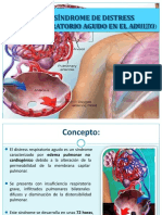 Sndromedeldistrsrespiratorioagudo 150327110516 Conversion Gate01