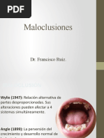 Clasificacion de Maloclusiones