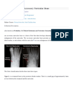 Accessory Navicular Bone