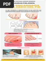 Infografia UÑA ENCARNADA DEL DEDO DEL PIE 