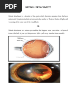 Retinal Detachment