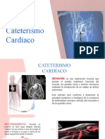 Cateterismo Cardiaco