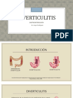 Diverticulitis 170312212001