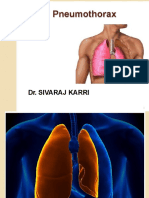 Pneumothorax: Dr. Sivaraj Karri