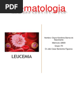 LEUCEMIA