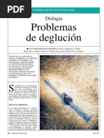 Problemas de La Deglucion