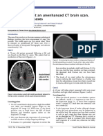 How To Interpret An Unenhanced CT Brain Scan. Part 2: Clinical Cases