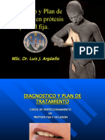 Diagnóstico y Plan de Tratamiento en Prótesis Fíja.