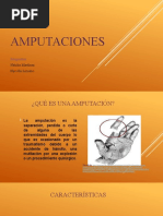 Amputaciones