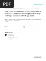 Palatal and Facial Veneers To Treat Severe Dental Erosion: A Case Report Following The Three-Step Technique and The Sandwich Approach