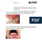 Lesiones Bucales