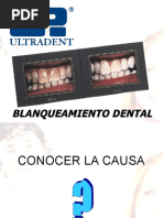 Blanqueamiento Dental