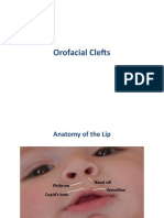 Orofacial Clefts