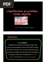 Equilibration Occlusale