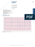 Atlas de EKG