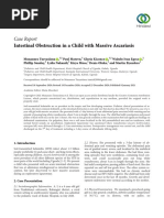 Case Report: Intestinal Obstruction in A Child With Massive Ascariasis