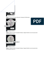 Observaciones Del Microscopio