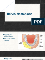 Nervio Mentoniano