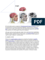 El Cerebro Del Corrupto