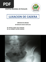 Luxación de Cadera