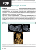 Exencephaly-Anencephaly Sequence: Consult Series