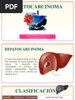 Hepatocarcinoma Diapo