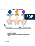 Breech Presentations