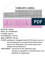 Ecg Notes